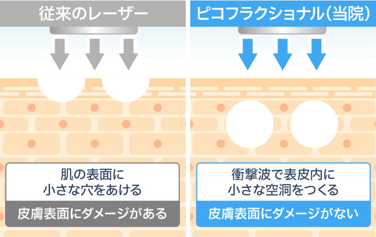 ピコフラクショナル