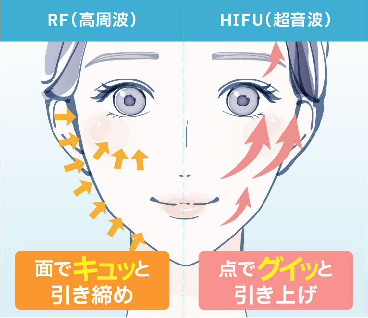 RFとHIFUの違い