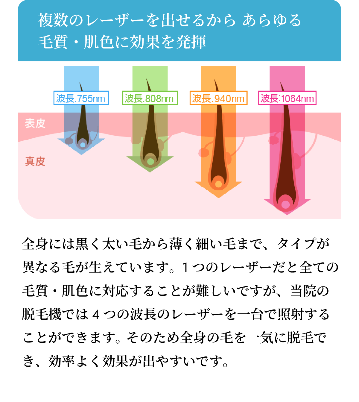 全身には黒く太い毛から薄く細い毛まで、タイプが異なる毛が生えています。1つのレーザーだと全ての毛質・肌色に対応することが難しいですが、当院の脱毛機では4つの波長のレーザーを一台で照射することができます。 そのため全身の毛を一気に脱毛でき、効率よく効果が出やすいです。