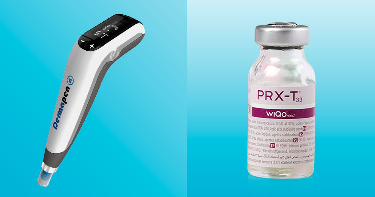 ウーバーピール導入（ヴェルベットスキン）