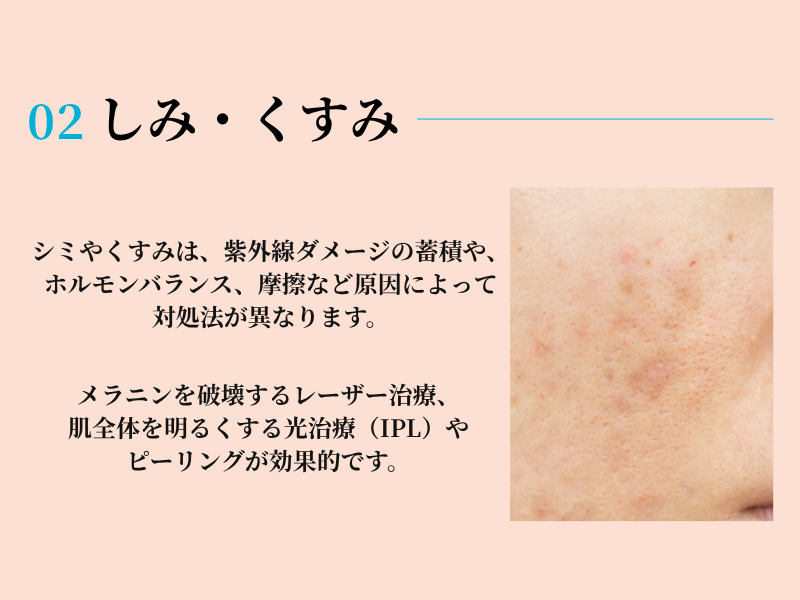 美容皮膚科キャンペーン