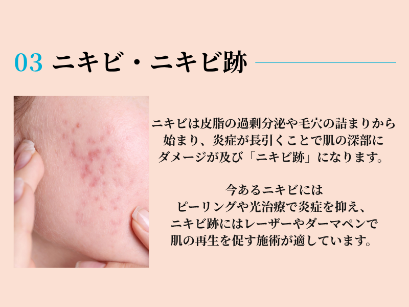 美容皮膚科キャンペーン