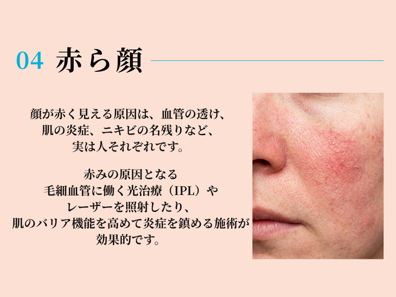 美容皮膚科キャンペーン