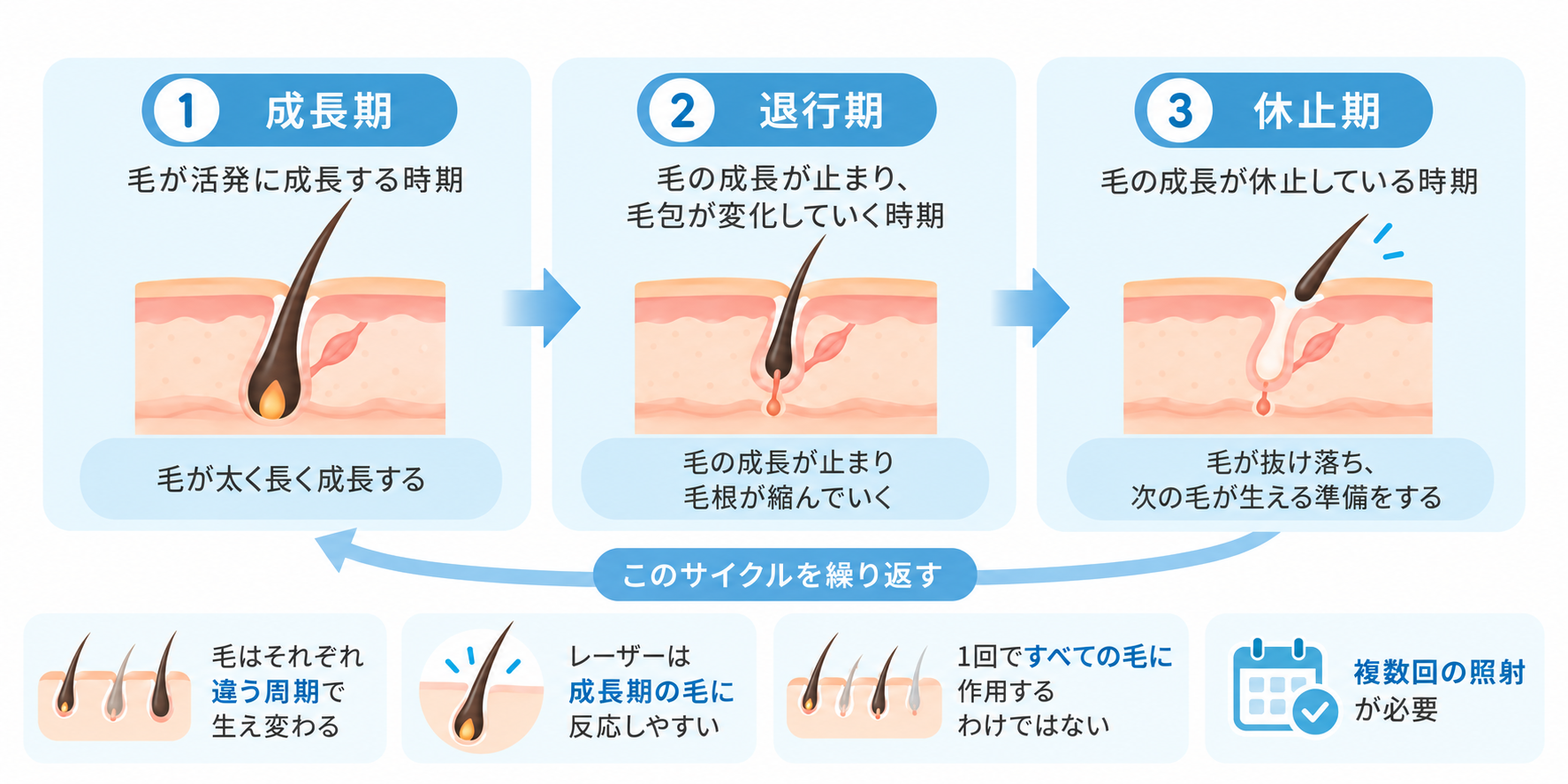 広島にある美容皮膚科　アークリシュ美容皮フ科の脱毛で毛が抜けるメカニズムと毛周期について解説した画像です。